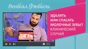 😁 Удалять или спасать молочные зубы? Клинический случай детской стоматологии "Дентал Фэнтези"