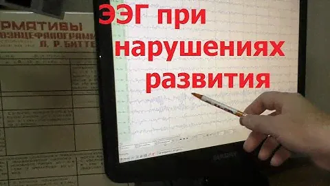 ЭЭГ при задержках речи и развития: когда нужна, что показывает и расшифровка